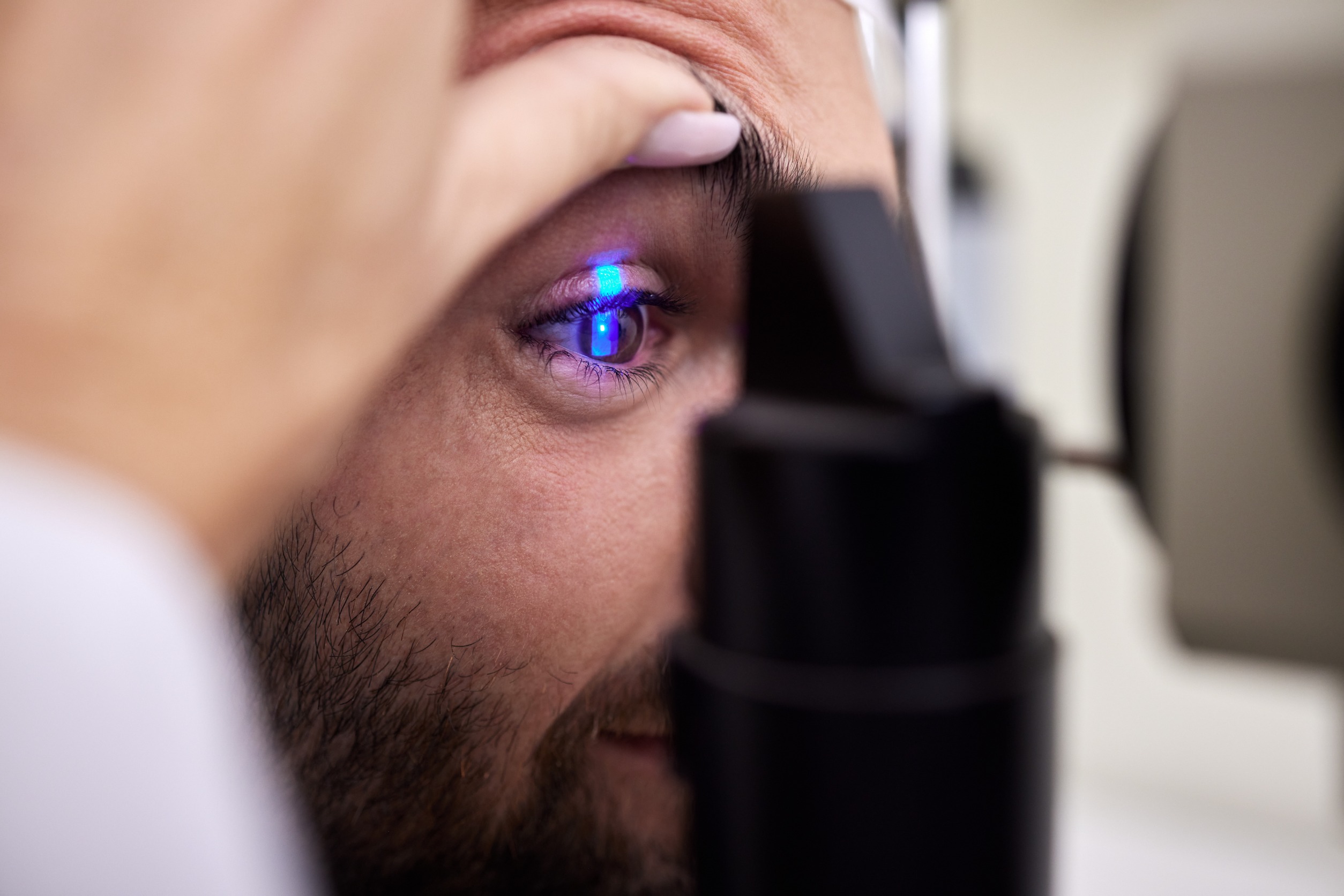 Close Up Of a Man Getting ready for LASIK Surgery