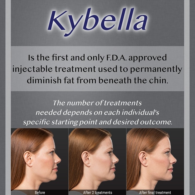 Greensburg Kybella Treatments
